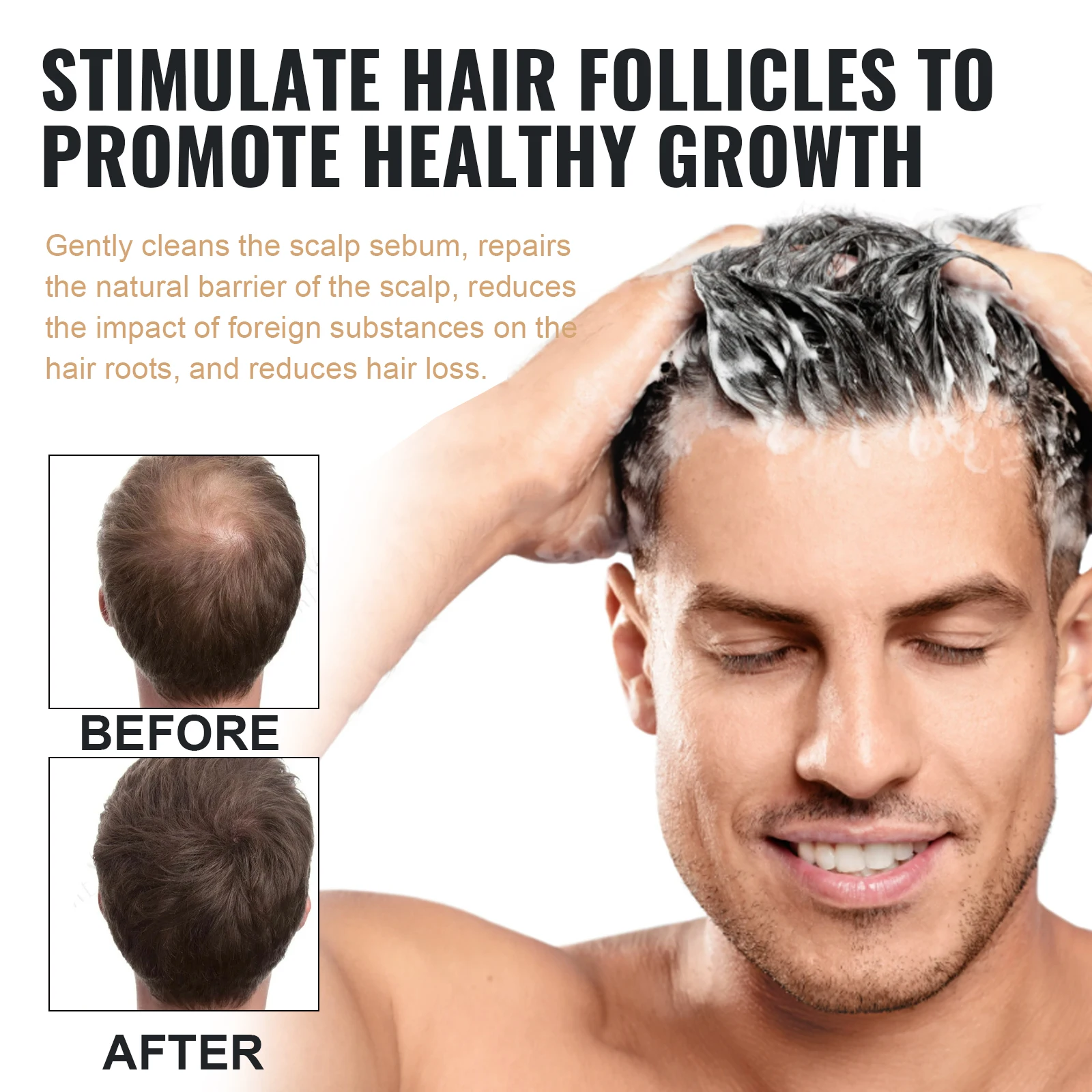 EELHOE 100 мл Шампунь для густ – обзор и цена Hair Care For Hair Fall