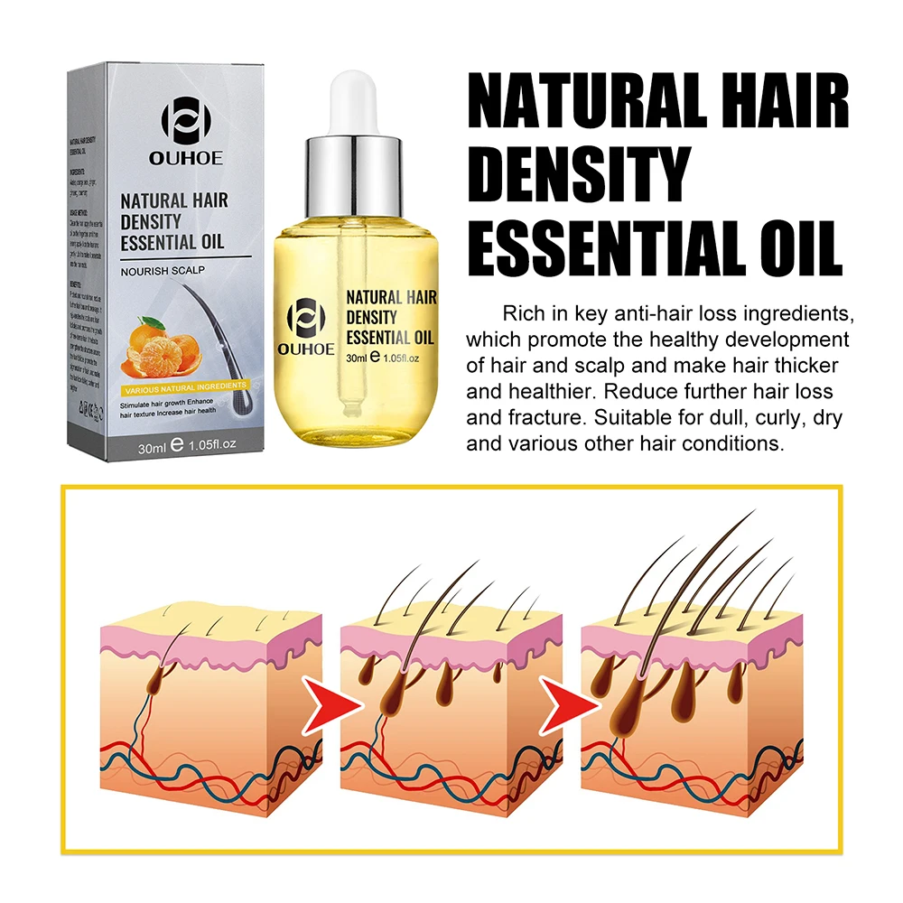 Hair Thickening Essential Oil 30ml Moisturizes Dense Repair Roots Damaged Strengthens Ginger Promote Growth Anti-loss