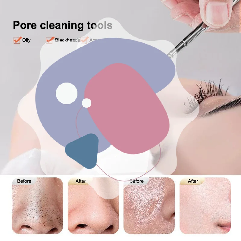 أداة إزالة الرؤوس السوداء للوجه مكشطة للوجه للتنظيف العميق وملعقة الأنف ومزيل الرؤوس البيضاء والعناية بالبشرة وأدوات التجميل #1