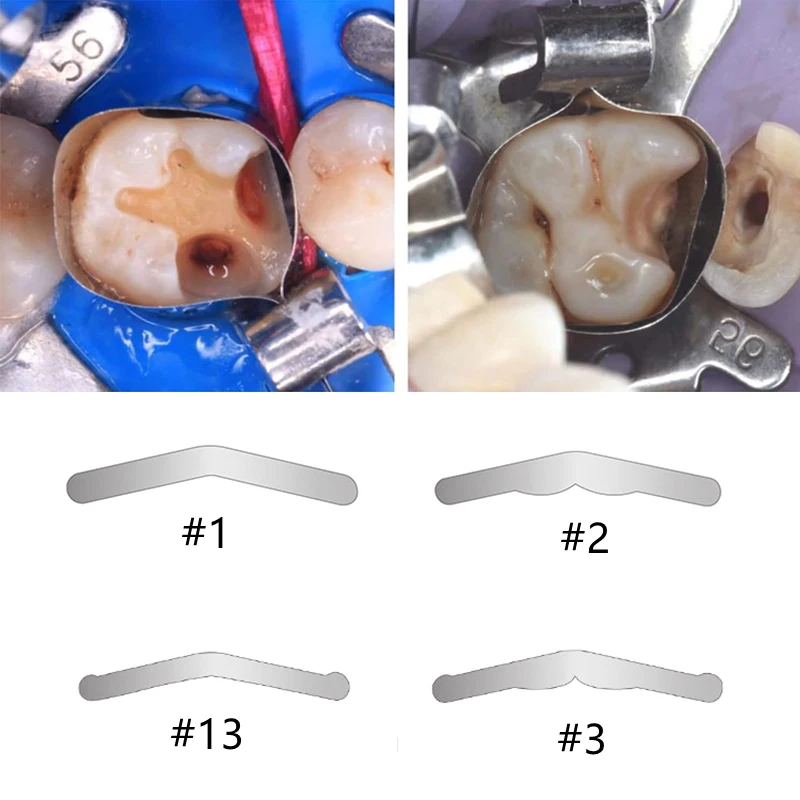 144Pcs Dental Tofflemire Matrix Bands Sectional Contoured Matrices Matrix Bands Stomatologiczne materiały do naprawy zębów ze stali nierdzewnej