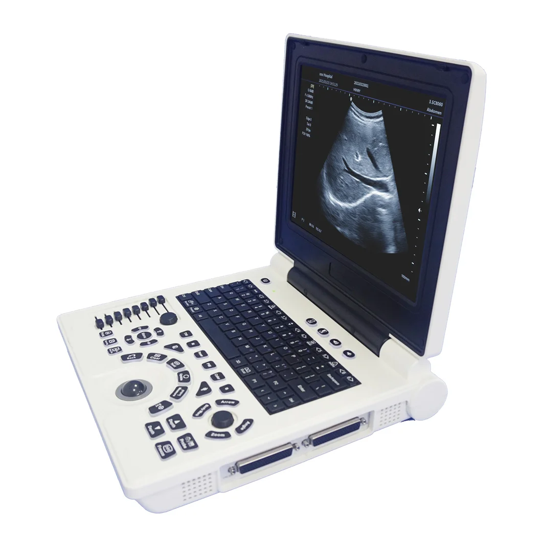 Medical ultrasound instruments Full Digital Portable Laptop BW obgyn 3mhz Ultrasound machine