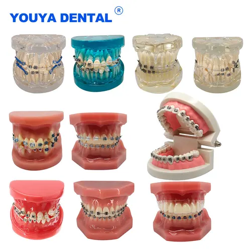 Modelo de dientes de tratamiento Dental de ortodoncia, estudio de enseñanza, modelos de dientes de encías con soporte de Metal ortopédico, lazos de ligadura de alambre de arco, Dentis