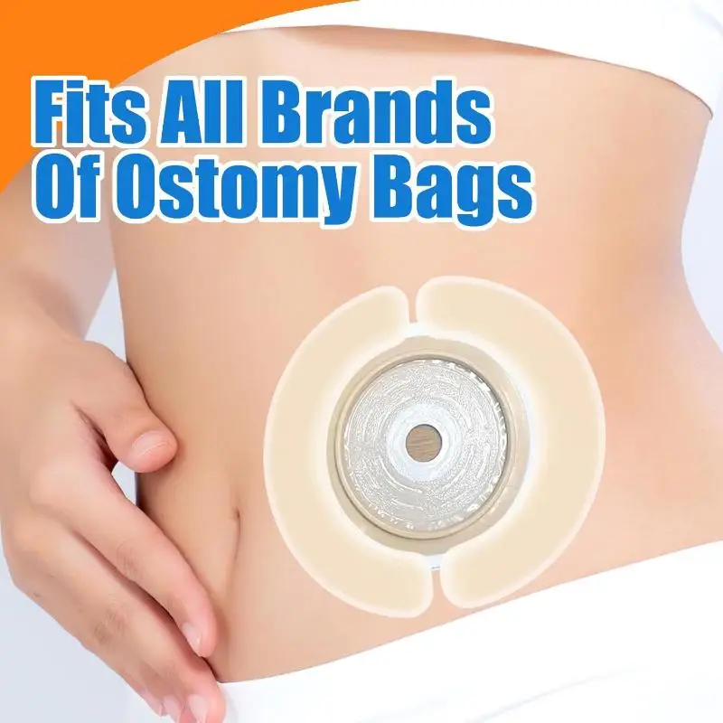 1/4 Pcs Hydrocolloid Waterproof Leak Skin Adhesive Ostomy Barrier Tape For Colostomy Bag Elastic Ostomy Barrier Strips