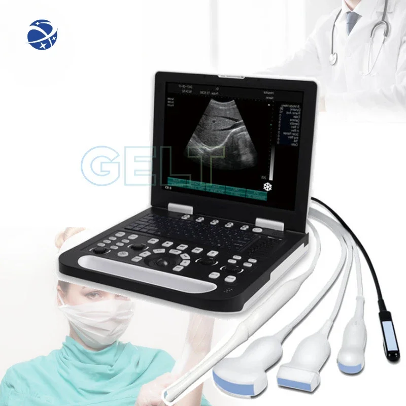 

High Quality Medical Ultrasonido Ultrasound Scanner Machine Human Pregnancy 3D 4D Color Doopler For Hospital