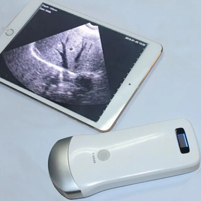 Mini wireless ultrasound machine probe Wifi ultrasound probe