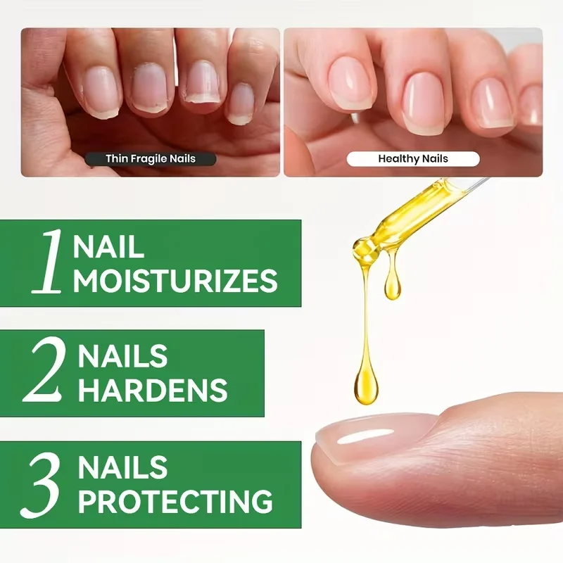 مصل تقوية أظافر الكركم لمدة 7 أيام، تركيبة خالية من الكحول، مناسبة لأظافر القدم والهشطة، سهلة الاستخدام.