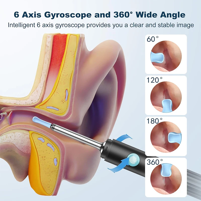 Electrical Ear Wax Removal, Ear Cleaning kit with 1080P Camera, Ear Camera with 6 LED Lights, Earwax Remover Tool for Phone