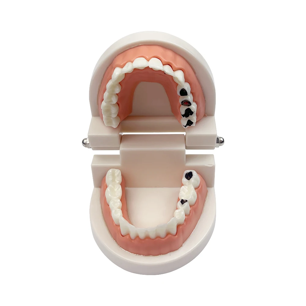 Dental dorosły standardowy model zębów Typodont metalowe / ceramiczne wsporniki do stomatologii dla dentysty modele szkoleniowe dla studentów