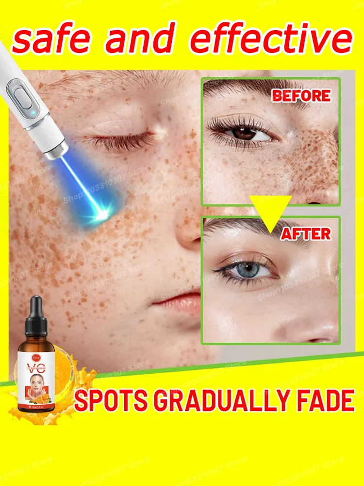 

Spots disappear, look younger