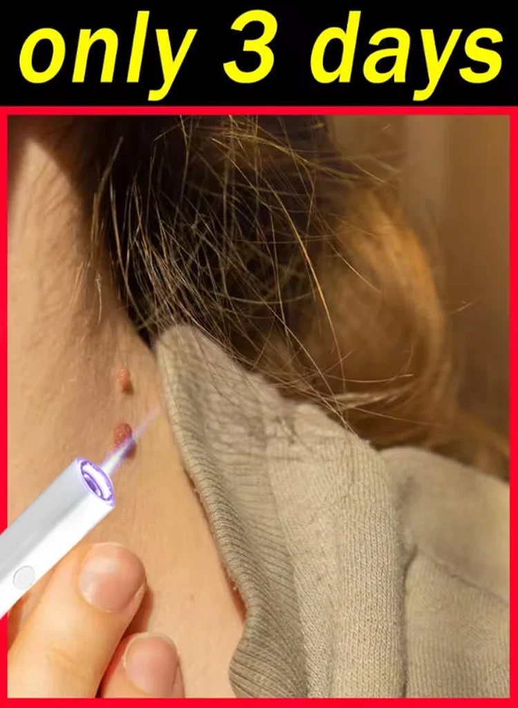 

Новинка Outil Wart Blue Light 2025 года, а также изысканные уборы sur Les.