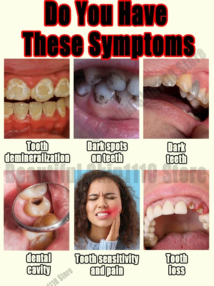 Tooth decay and caries ʀᴇᴘᴀɪʀ Eɴᴀᴍᴇʟ ʀᴇɢᴇɴᴇʀᴀᴛɪᴏɴ