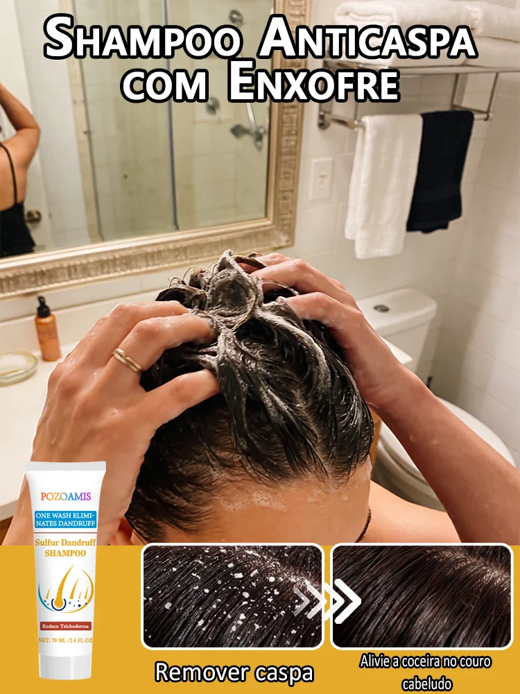 sulfur-anti-dandruff-shampoo-anti-itch-oil-control-deep-cleansing-scalp-care-shampoo-for-men-women-daily-use