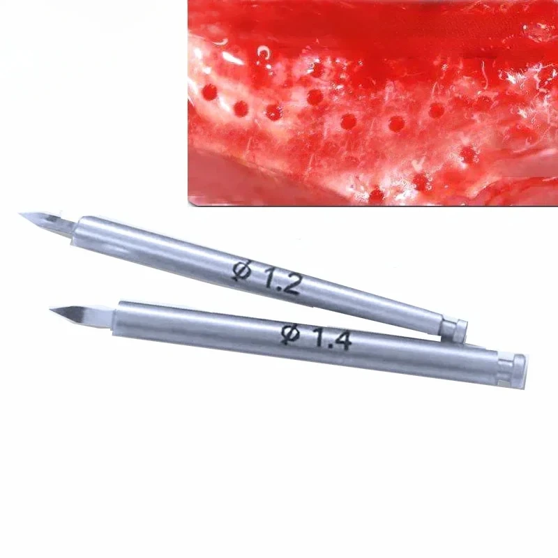 Dental Nutrient Drill Implant Bone Increment Implant Nutrient Hole Drill Promote New Bone Formation Bone Drill Dental GBR