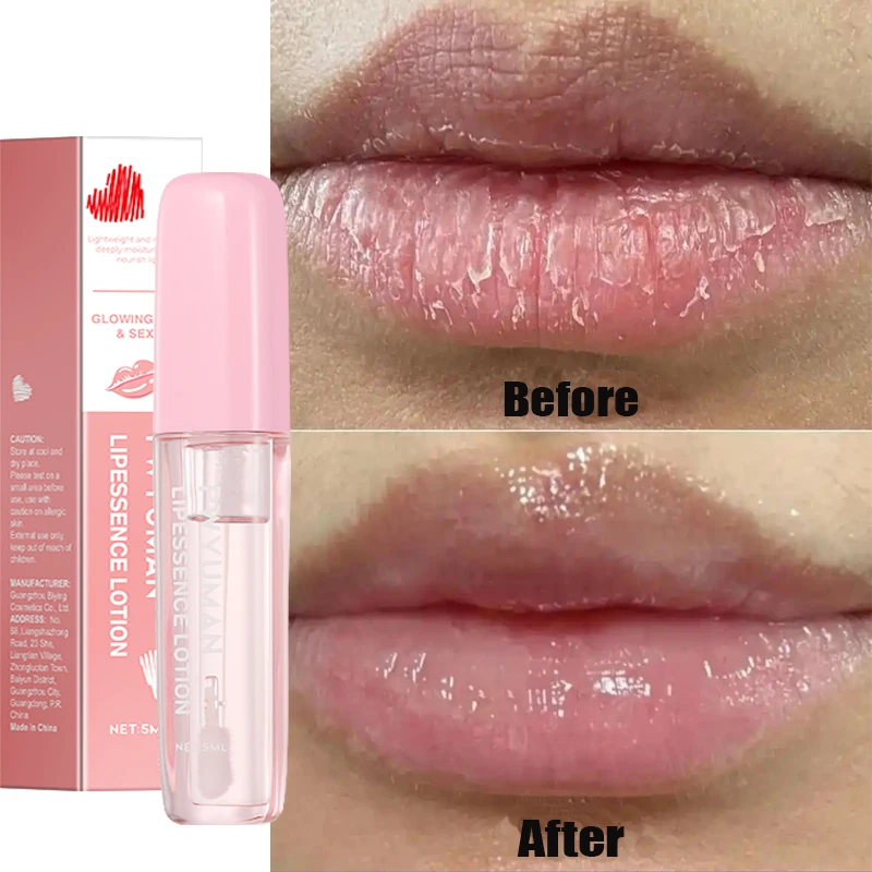 Rimuovere il fumo scuro Balsamo per le labbra Schiarente Melanina Sbiancamento Gloss Olio Labbra Rossetto rosa Esfoliante Dissolvenza Linee delle labbra Cosmetici coreani