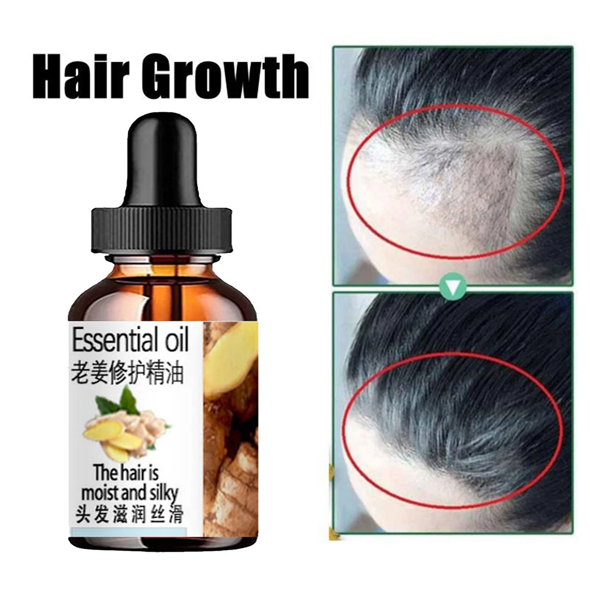 Hair Growth Products Ginger Fast Growing Hair Essential Oil Beauty Hair Care Prevent Hair Loss Oil Scalp Treatment For Men Women