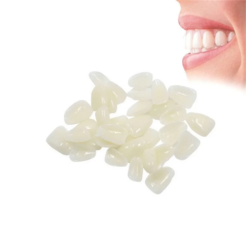 Impiallacciature dentali tempo - Teeth Whitening Veneers recensione e prezzo