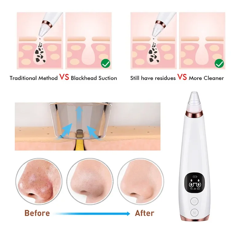 Aspirateur électrique pour points noirs, nettoyeur d'acné, élimination des taches noires, nettoyage en profondeur du visage, nettoyeur de pores, machine, outils de soins de la peau