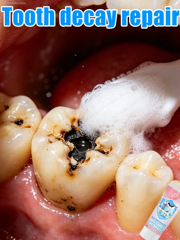 Proper dental care can prevent tooth decay from recurring.