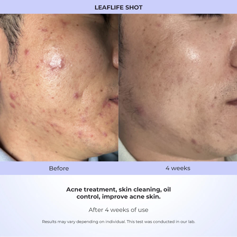 목 리프팅 타이트닝 기기 안티에이징 바디 페이셜 케어 마사지 다기능 미세전류 페이셜 토닝 기기 여성 남성용