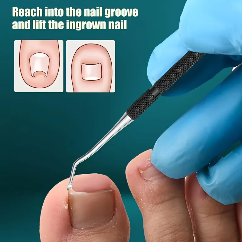3-teiliges Set für eingewachsene Zehennägel, Nagelknipser mit Spitze, Nagelzange für eingewachsene Nägel, Pediküre-Werkzeug für dicke, harte Zehennägel – Detail 3