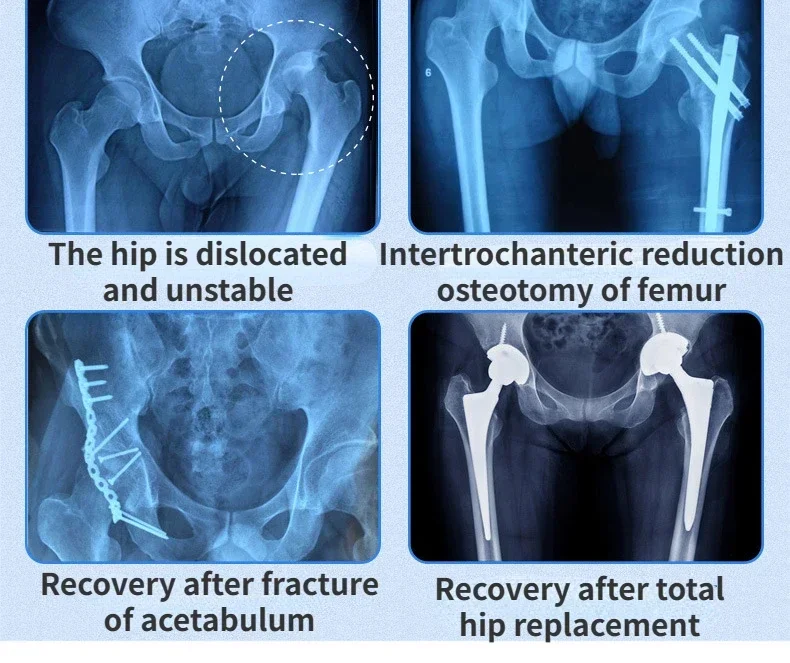 Adjustable Medical Hip Support Belt Dislocation Fixation Band Postoperative Injury Rehabilitation Orthosis Stabiliser Corrector
