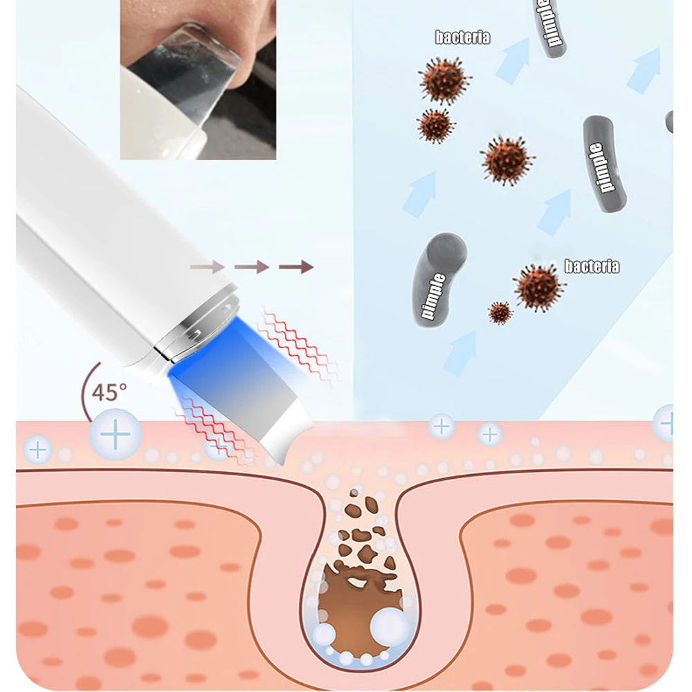 Épurateur de peau à ultrasons, dissolvant de points noirs, nettoyage en profondeur du visage, nettoyeur de pores à l'ions ultrasoniques, pelle pour le visage