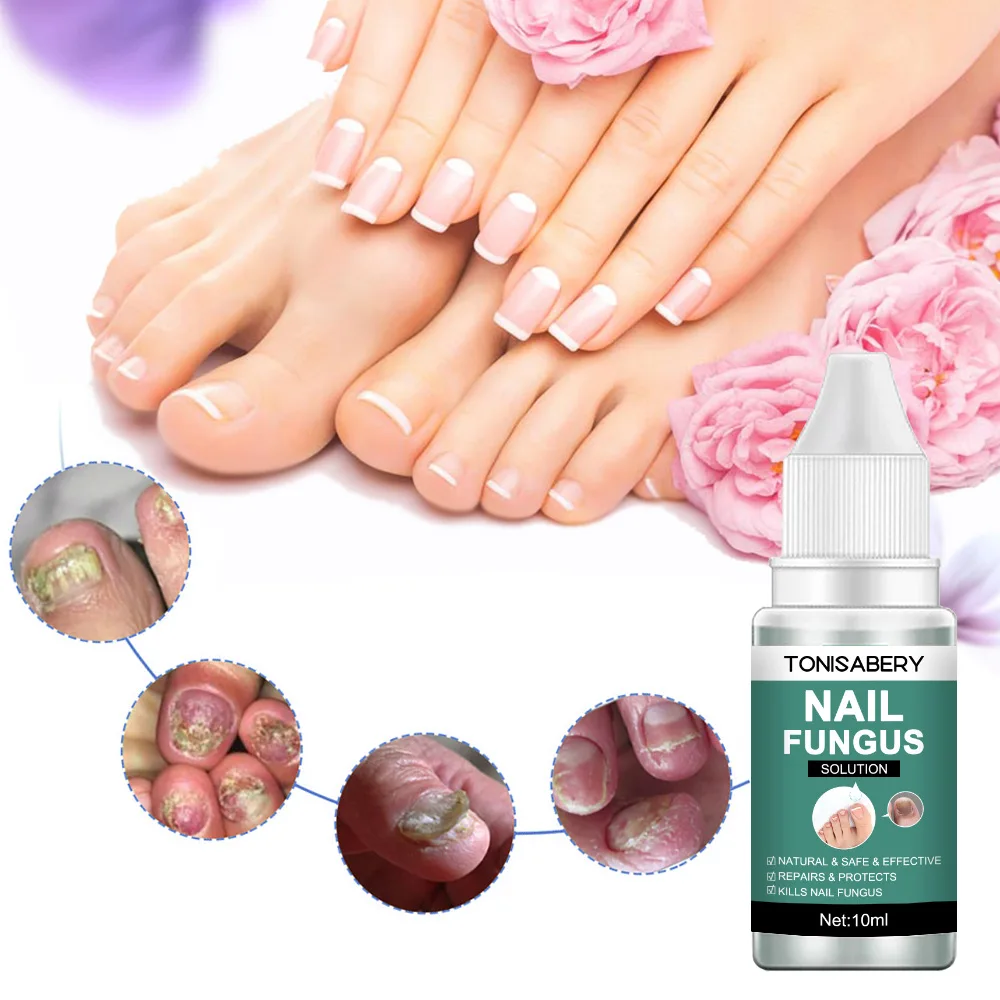 Nail Fungal Treatment Feet Care Essence Anti Infection Onychomycosis Removal Toe Nails Foot Fungus Paronychia Nail Care Uñas