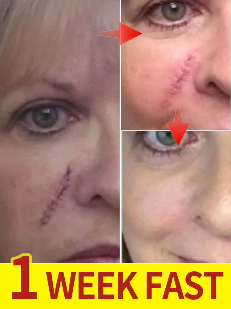 

TrueTexture Scar Serum - Micro-Fiber Weave & Hydra-Fusion