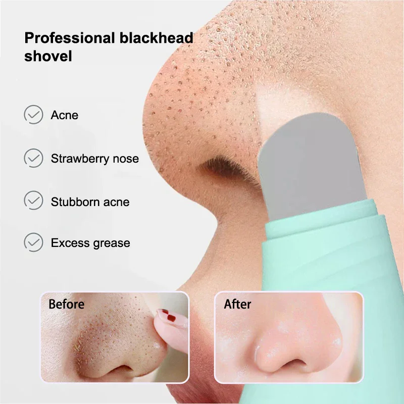 Facial Blackhead Removal Tool Face Scraper For Deep Cleansing Face Acne Foundation Spatula Nose Whitehead Remover Skin Care Tool