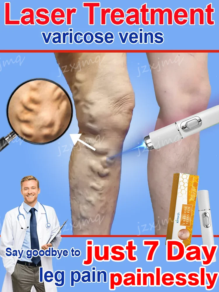 

Varicose Veins Pen Blue Light Laser