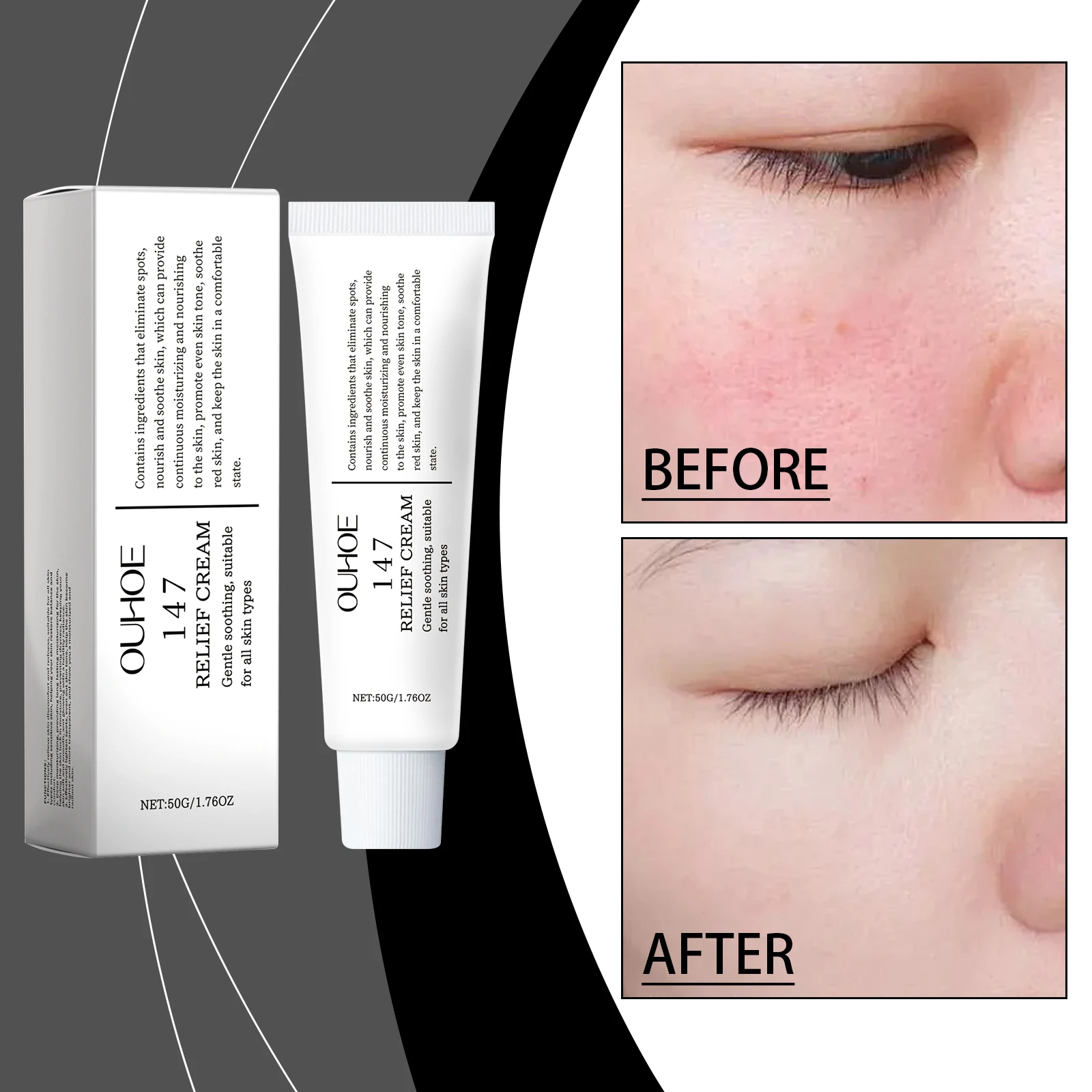 Crema Sollievo - Crema Viso Correttrice e Lenitiva delle Macchie, Trattamento delle Macchie Scure con Formula Nutriente per Anche Il Tono Della Pelle