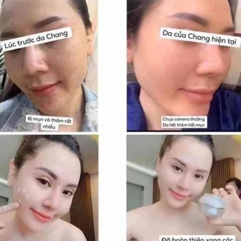 Face Pháp A COSMETICS kem dưỡng trắng da 50g remove dark skin white kem face phap tri nam tan nhang ngan ngua mun tham