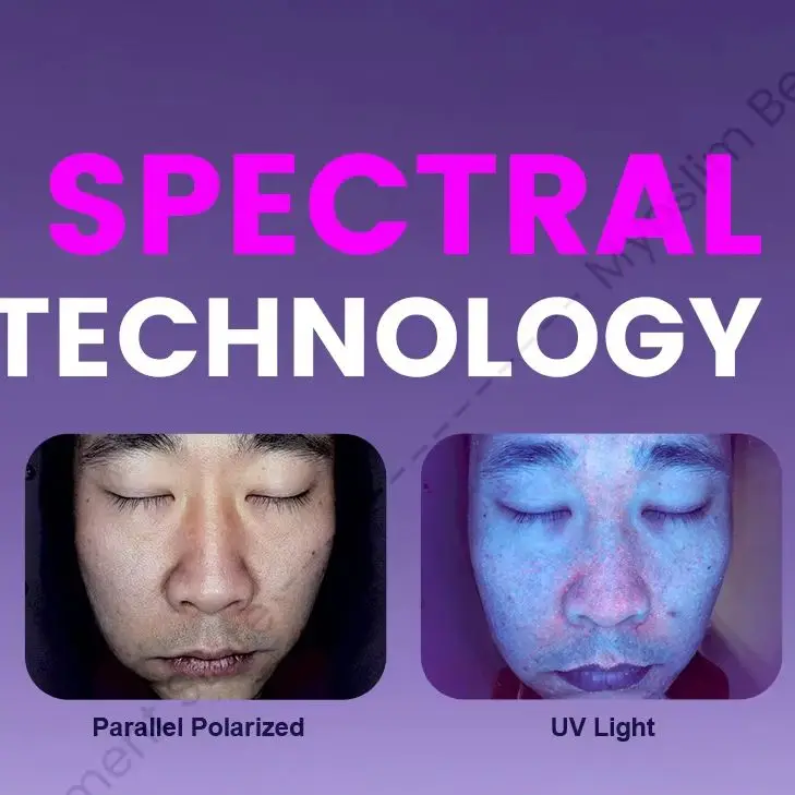 15.6 Inch X3 Pro Facial Skin Analyzer 3D AI Hair Analysis Machine 8 Light Spectrum Skin Analysis Scanner Business Machine