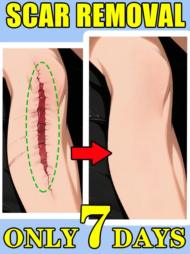 

Are your ʰʸᵖᵉʳᵗʳᵒᵖʰⁱᶜ scars itchy and hard Stop ˢᶜʳᵃᵗᶜʰⁱⁿᵍ ᵗʰᵉᵐ! Repair them now!