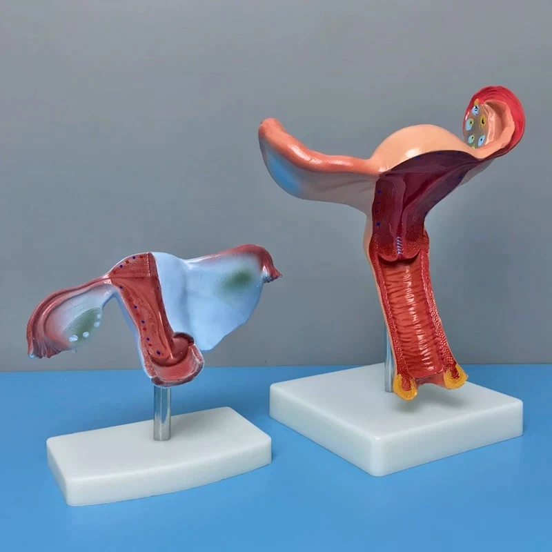 Female Human Reproductive System Anatomical Model Detachable Uterus & Ovary Structure for Obstetrics Gynecology Medical Teaching