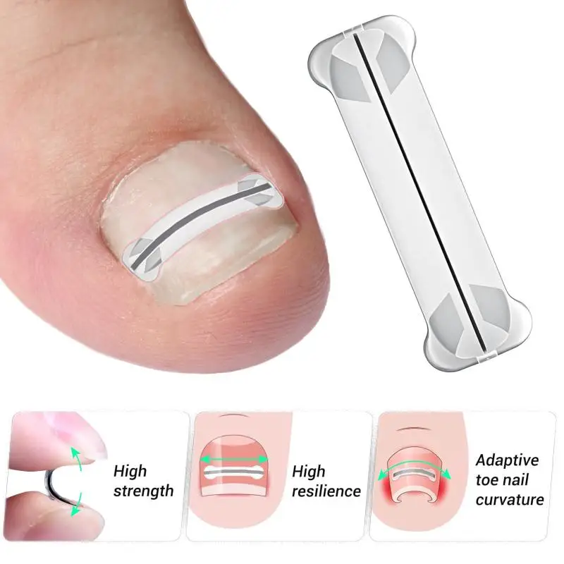 1Pcs 13-20mm Nail Correction Stickers Ingrown Toenail Corrector Patches Paronychia Treatment Recover Corrector Pedicure Tools