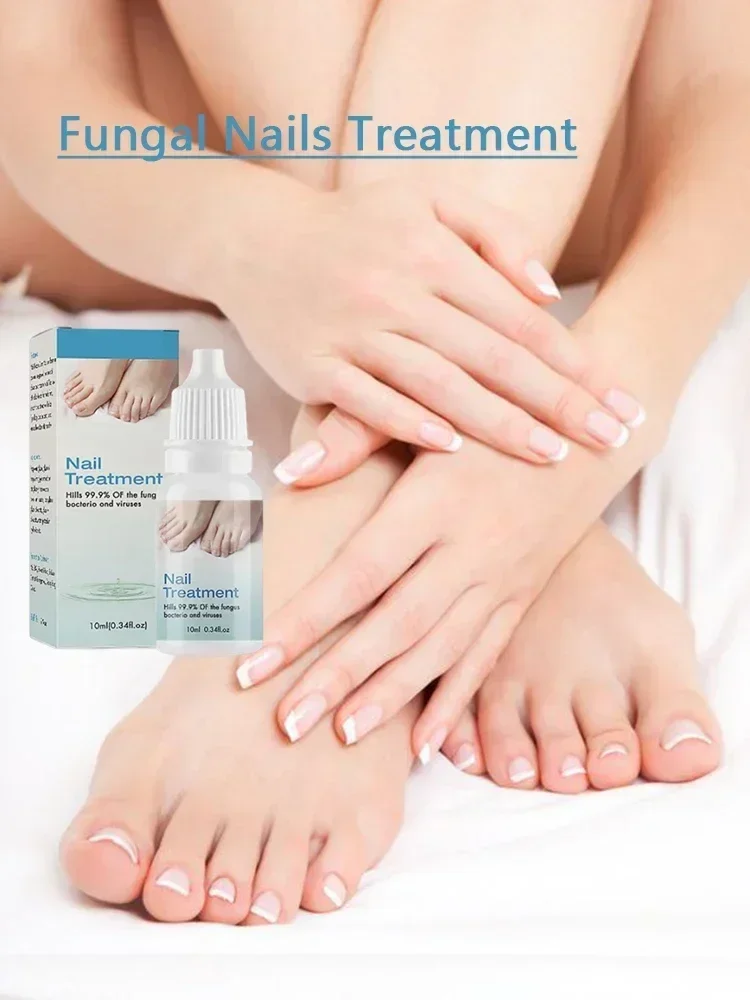 HOT SALE Nail Fungus Treatment Serum Foot Repair Liquid Toe Nail Fungus Removal Gel Anti Infection Paronychia Onychomycosis oil