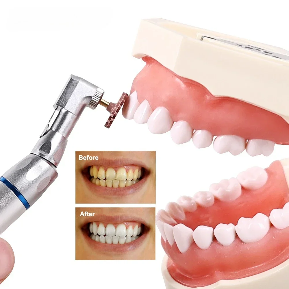 

SYJH 6Pcs/Box Dental Composite Resin Polishing Disc Wheel Kit Rubber Polisher Spiral Burs 2 Step Polishing System Wheel Tools