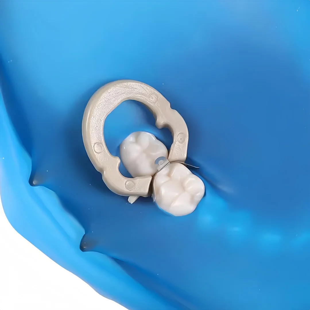 100 قطعة/صندوق M4 الأسنان المعادن مصفوفة الفرقة احيط الاقسام نظام مصفوفة لاستعادة الأسنان أدوات طب الأسنان 3.5/4.5/5.5/6.5 مللي متر