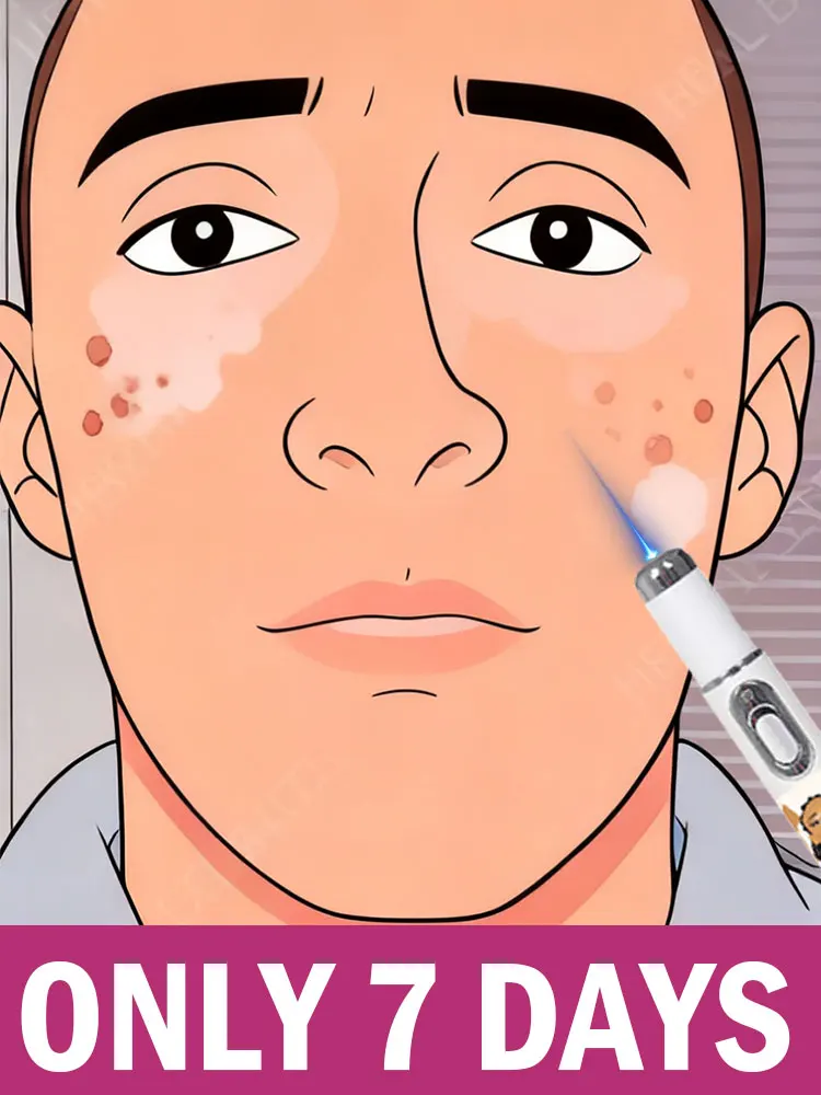 New Device and Upgraded Version⸴Vitiligo