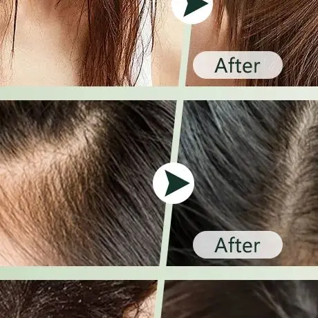 US Stock Arborvitae Leaf Shampoo Soap Strongly Fight Dandruff Strengthen Hair Root Effective Oil Control Prevent Hair Loss Solid