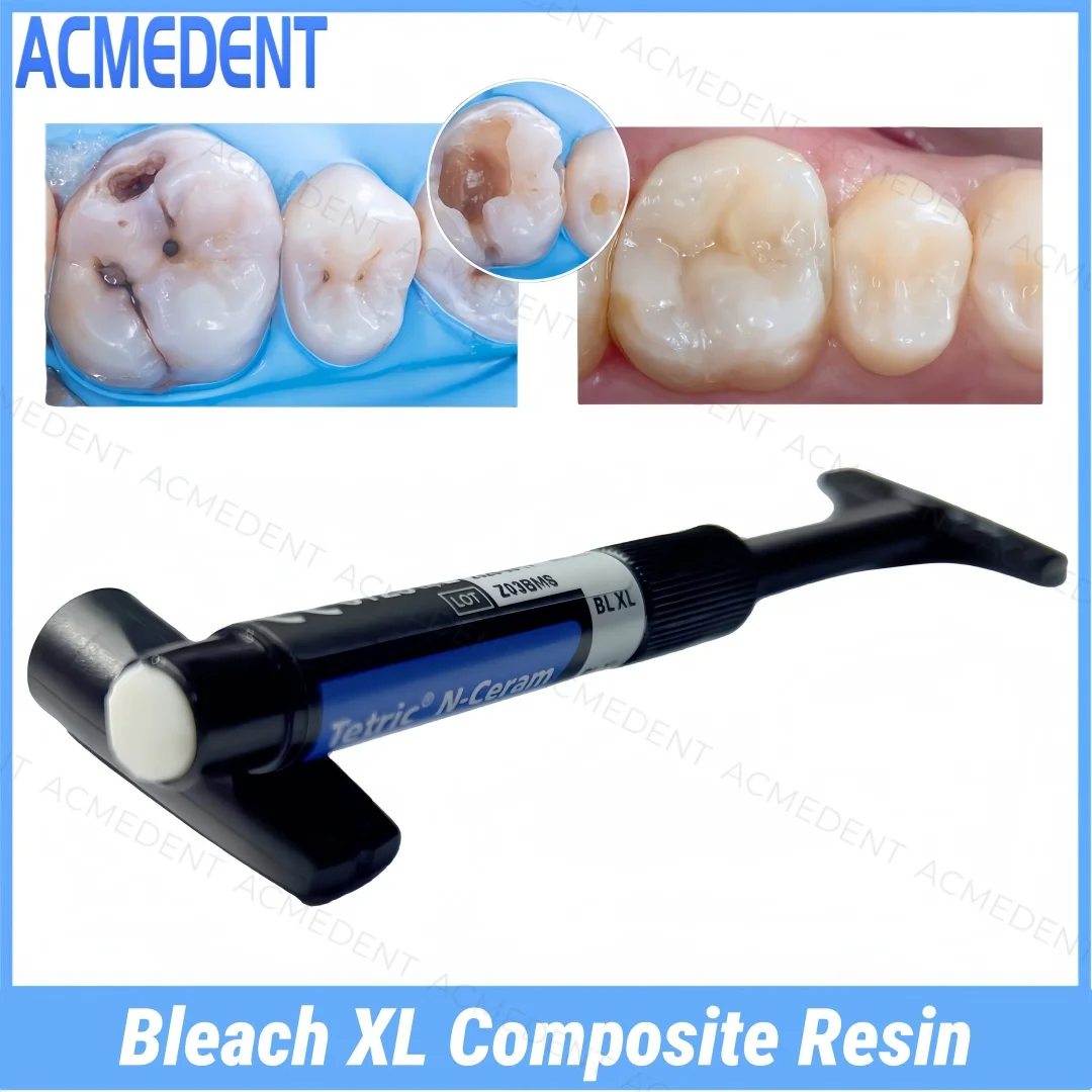 

BLXL Dental Tetric N-Ceram BL XL Composite Syringe Resin Light Cure Filling Material Bleach Extra Light Bleach Whitening Veneer