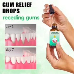 Gum Repair Drops Serum, Aliviar A Receding, Inchaço Gengival, Cuidados com Manchagens, Higiene Periodontal Oral, Remover Amarelo