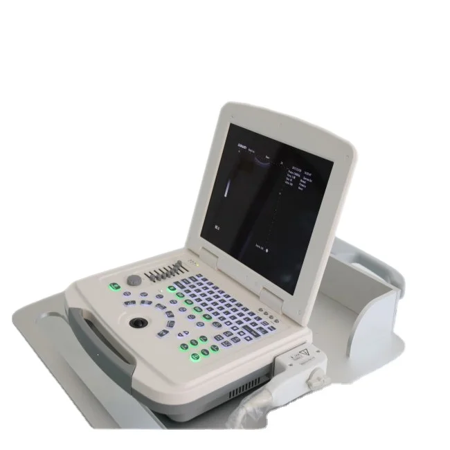 Hospital laptop ultrasound Scanner portable medical with  probes and travel case price ultrasound scanner 3D ultrasound Machine