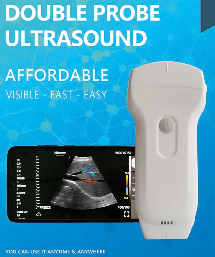 Double Probes cardiology Color Doppler Ultrasound Scanner 3 in 1 cardiac linear convex abdominal wireless android ultrasound