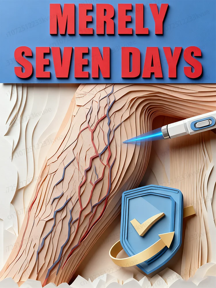 Laser vein pen Remove varicose veins from the body