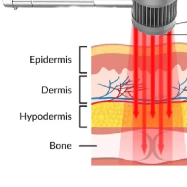 

Ветеринарный лазерный терапевтический аппарат с красным светом 650 нм 808 нм для животных - лечение артрита, дисплазии тазобедренного сустава и заживления ран у собак и кошек