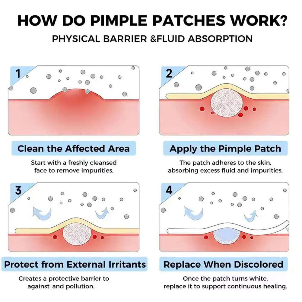 Superstar Hydrocolloid Pimple Patches 280/1120/1680Pcs Acne Patch Gentle And Non Irritating Absorption Acne Patch Patch