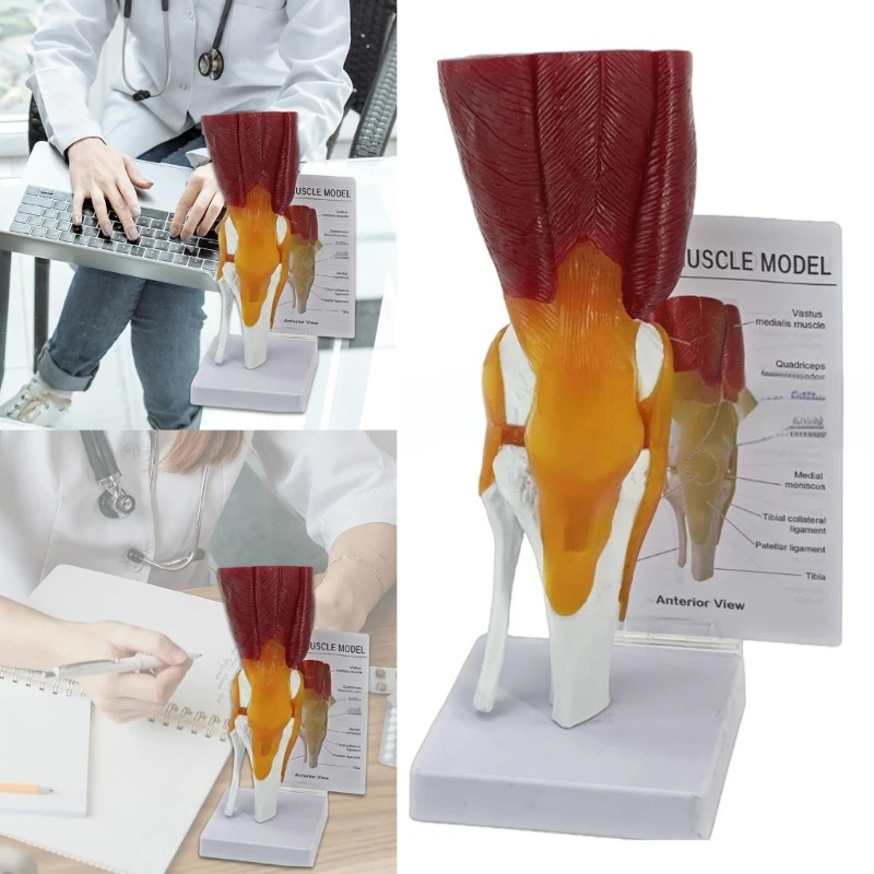 

Human Knee Joint Muscles Ligaments Anatomically Model Human Knee Anatomy Model Human Knee Joint Model For Science Class