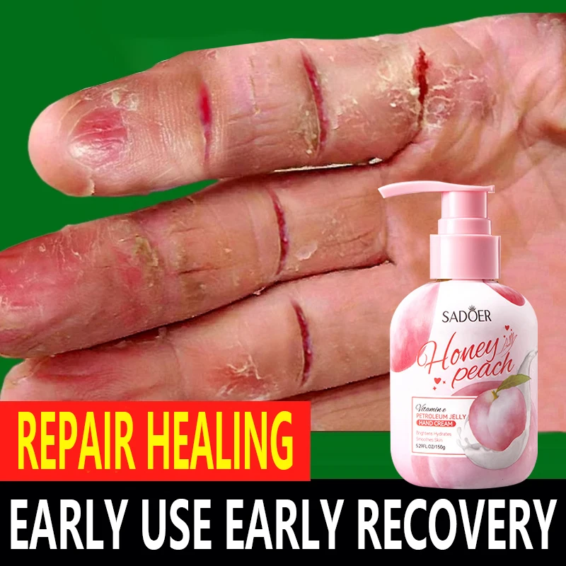 

Vaseline hand cream is moisturizing, hydrating and long-lasting. It prevents dryness,chapping and roughness in autumn and winter
